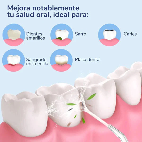 AquaSmile Irrigador bucal limpieza profunda portatil